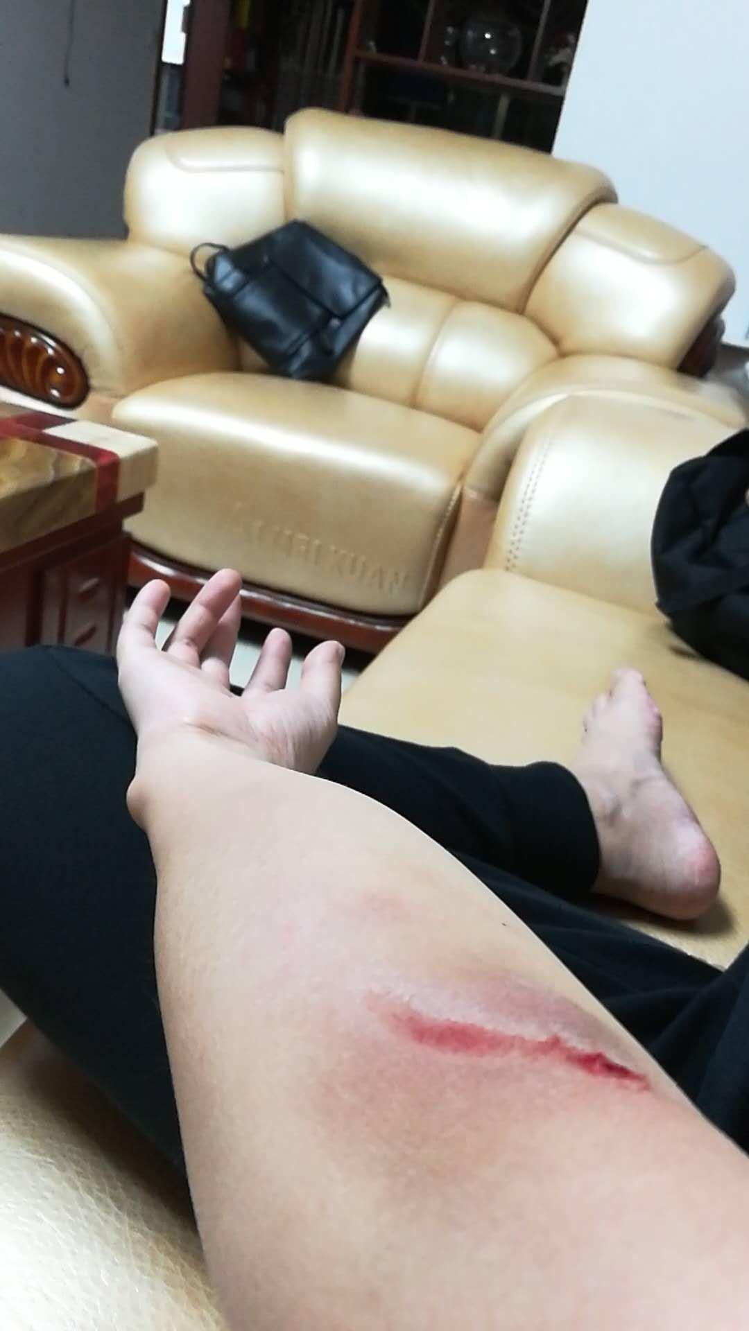 玩滑板摔倒是一种怎样的体验