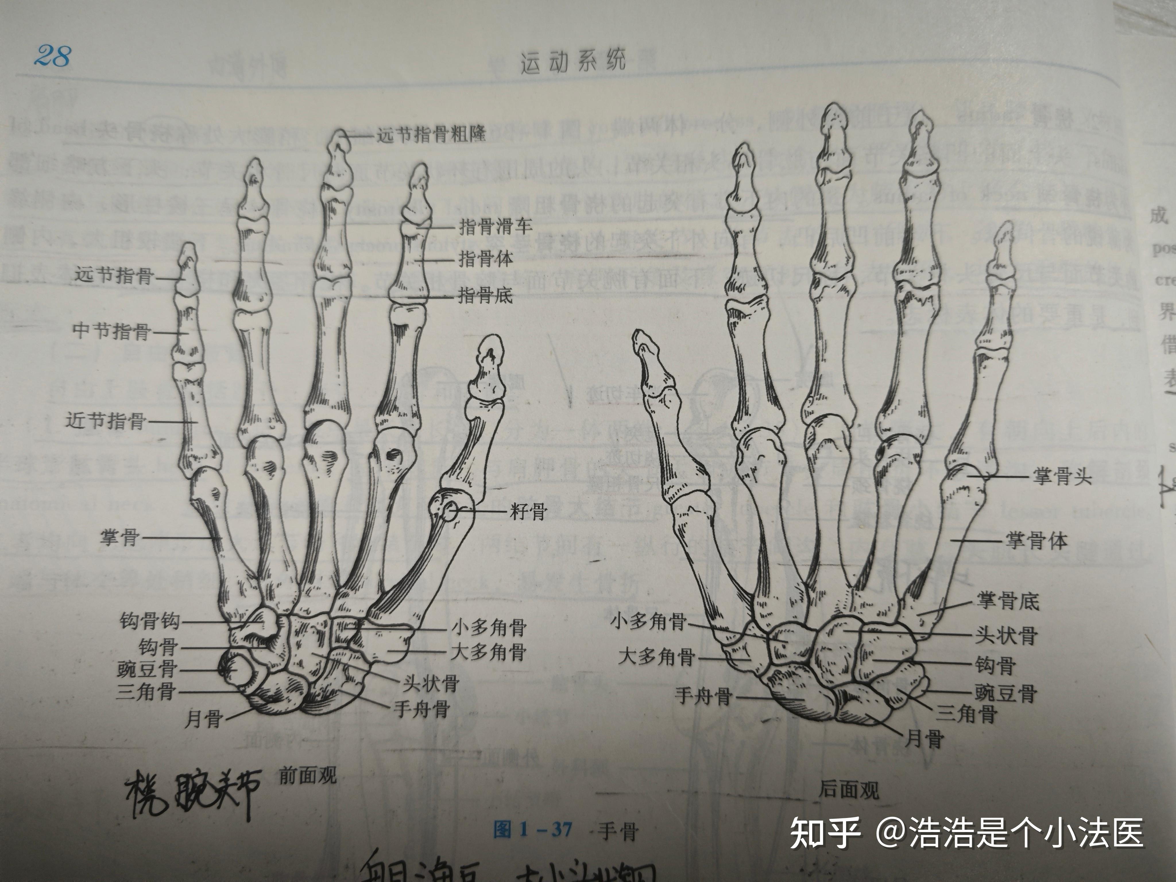 掌骨骨折到底属于什么伤?