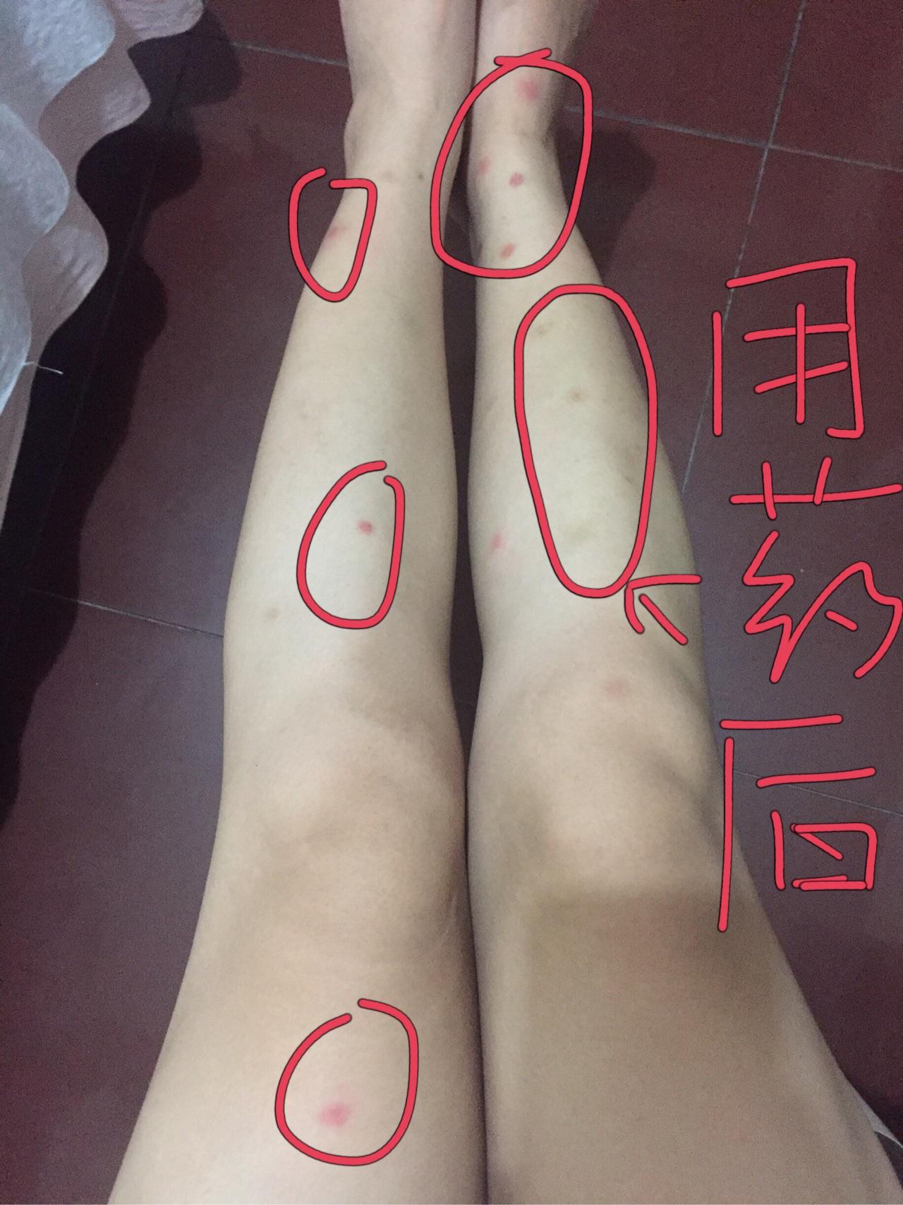 v2-b1f7f5a655807cb3d4a375c6e31e3f98_r.jpg