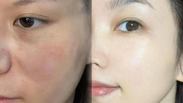 推荐的抗老面霜真的去法令纹巨牛,连续用了2个月,法令纹垮脸都被拽