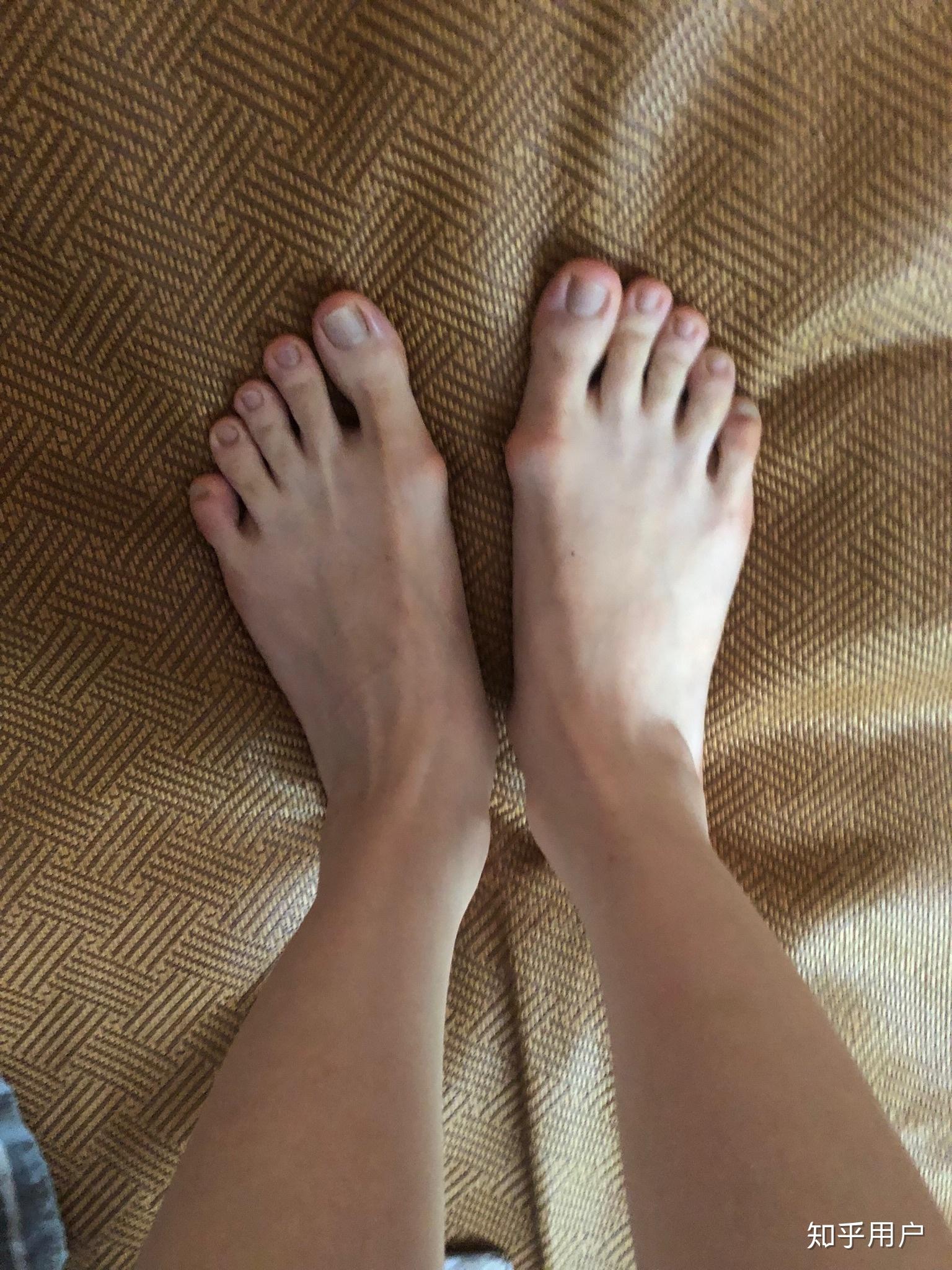 女生脚丑是种什么样的体验