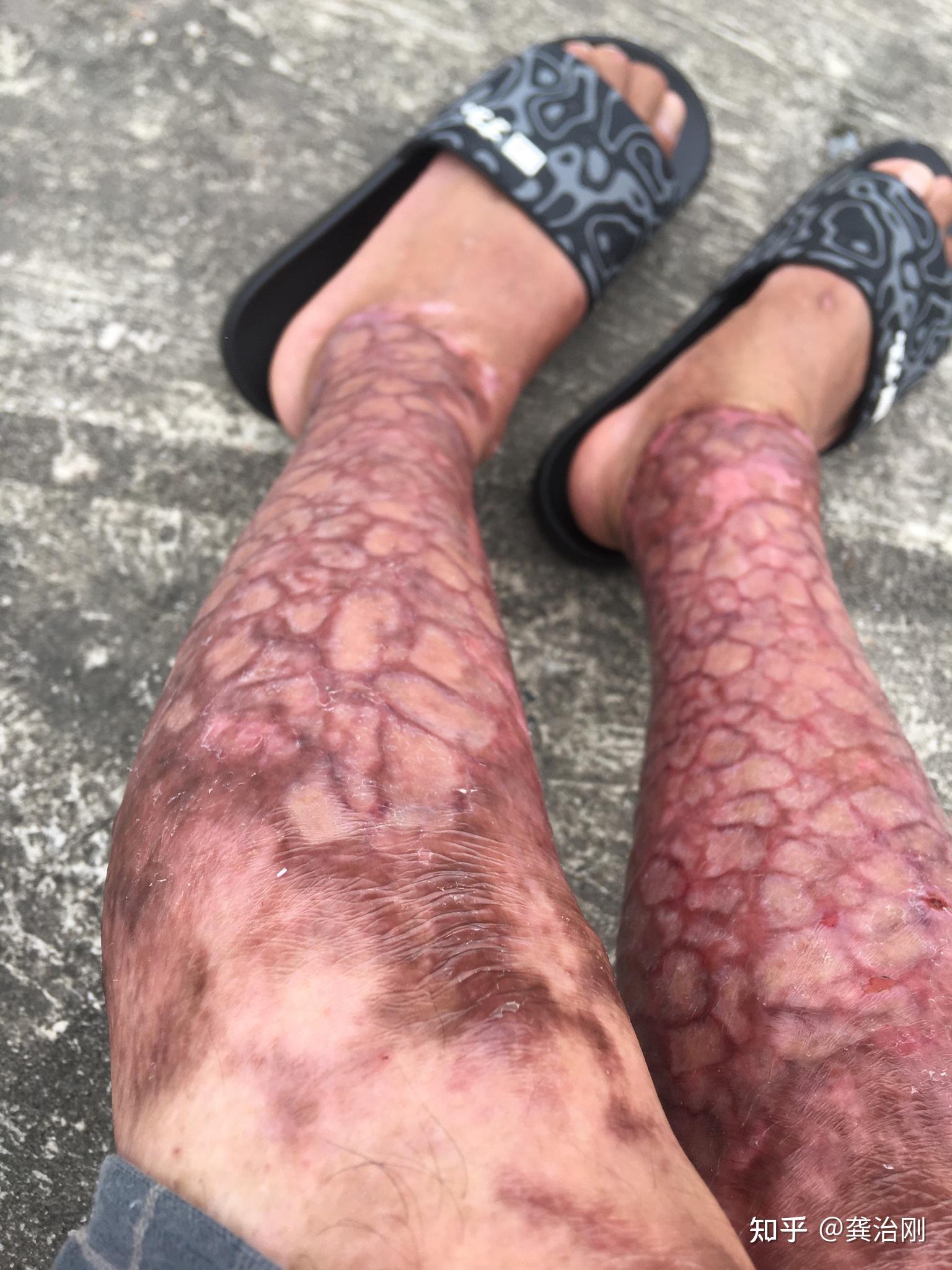 发生工伤事故,个人寻找司法鉴定中心出具的鉴定结果,具有法律效应吗?