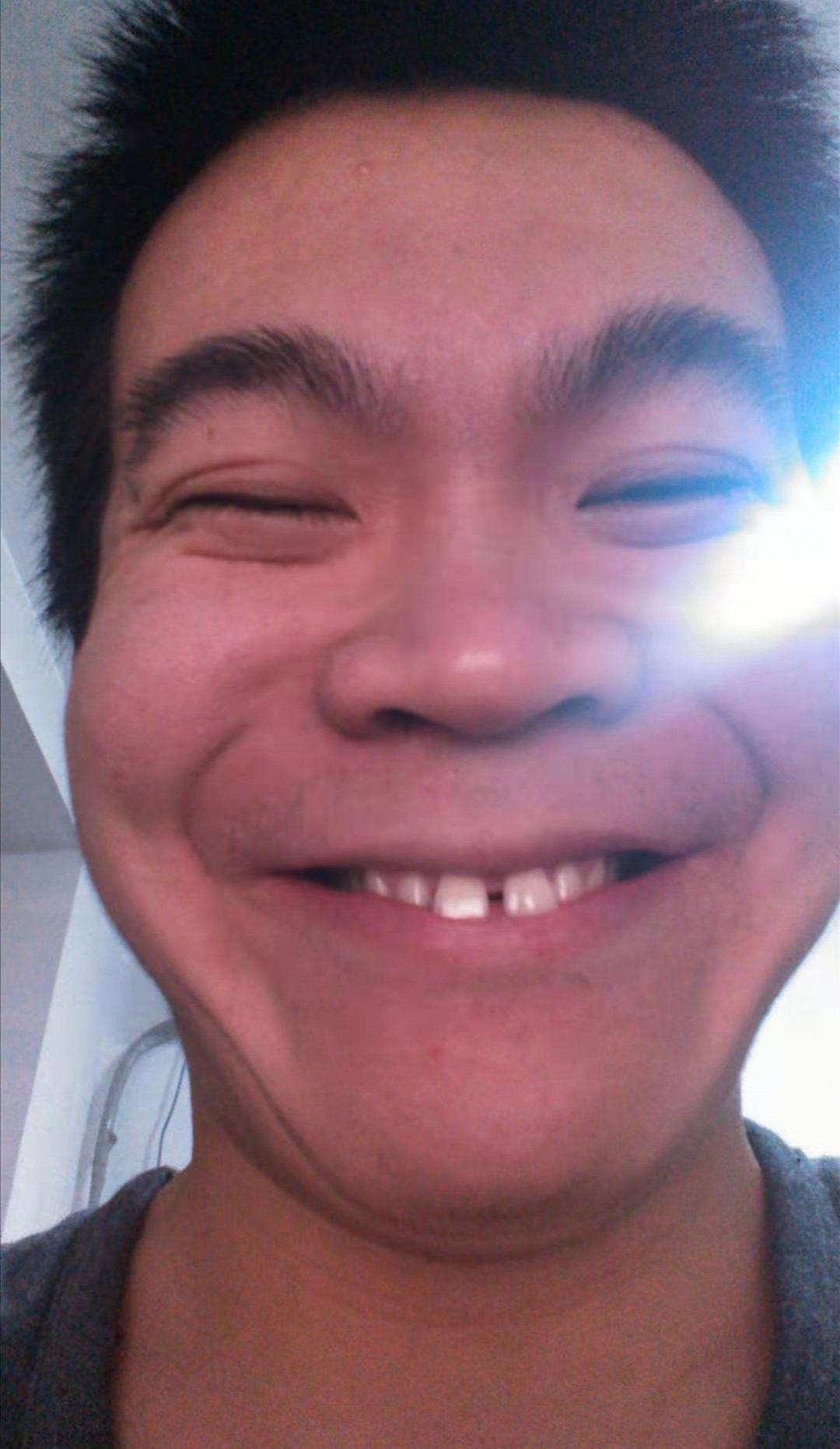 男生寸头可以有多丑