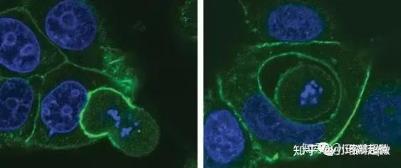 第二十八期：透射电镜下的细胞侵入性死亡（Entosis） - 知乎