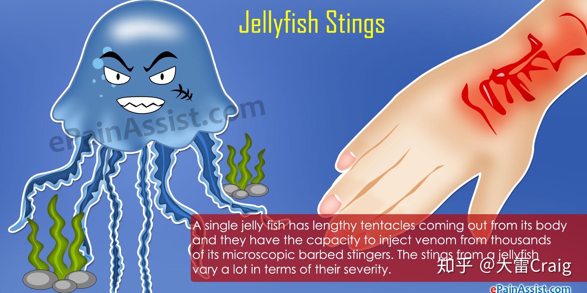 被水母蛰是一种什么体验