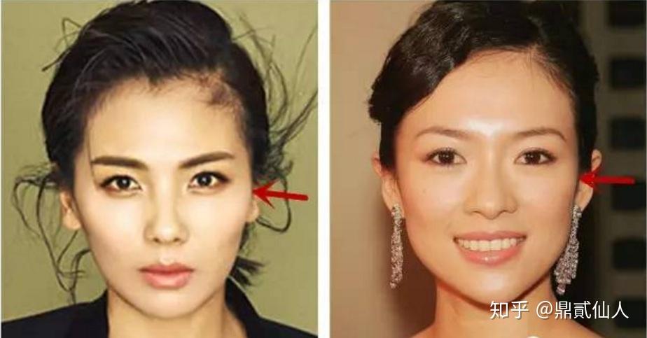 为什么觉得最近颧骨越来越外凸,也没变瘦啊,现在17岁?