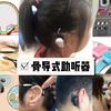 外耳道真菌病 知乎 外耳道真菌病 知乎