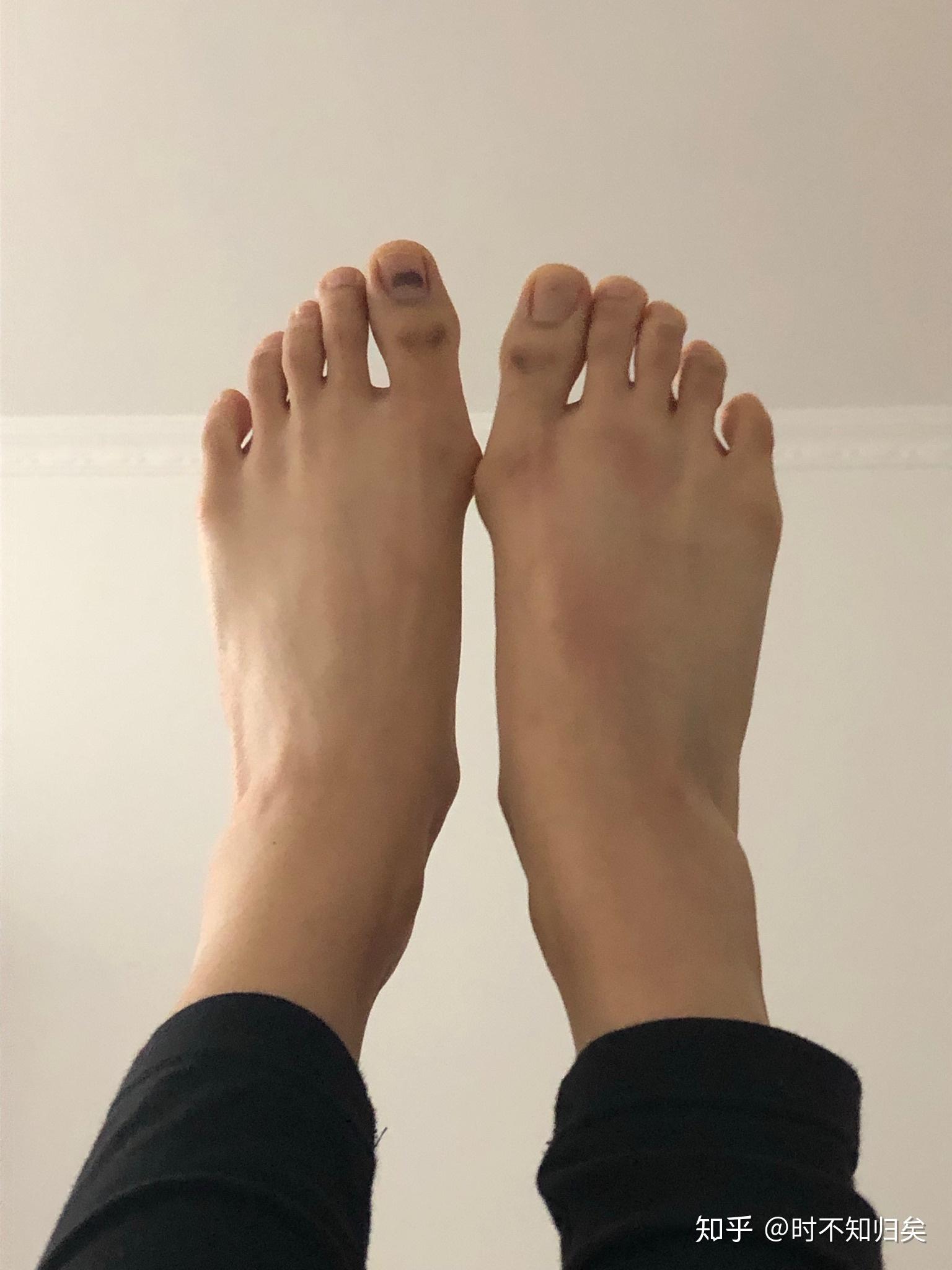 女生脚丑是种什么样的体验