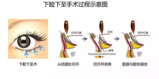 v2-b63335501b55b2b82a611f7f84da123e_1440w.jpg?source=172ae18b