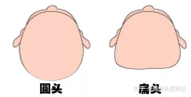 扁头对于脸型有影响吗?是不是后脑勺比较平脸就显大 - 知乎