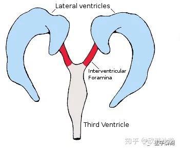 侧脑室解剖 - 知乎