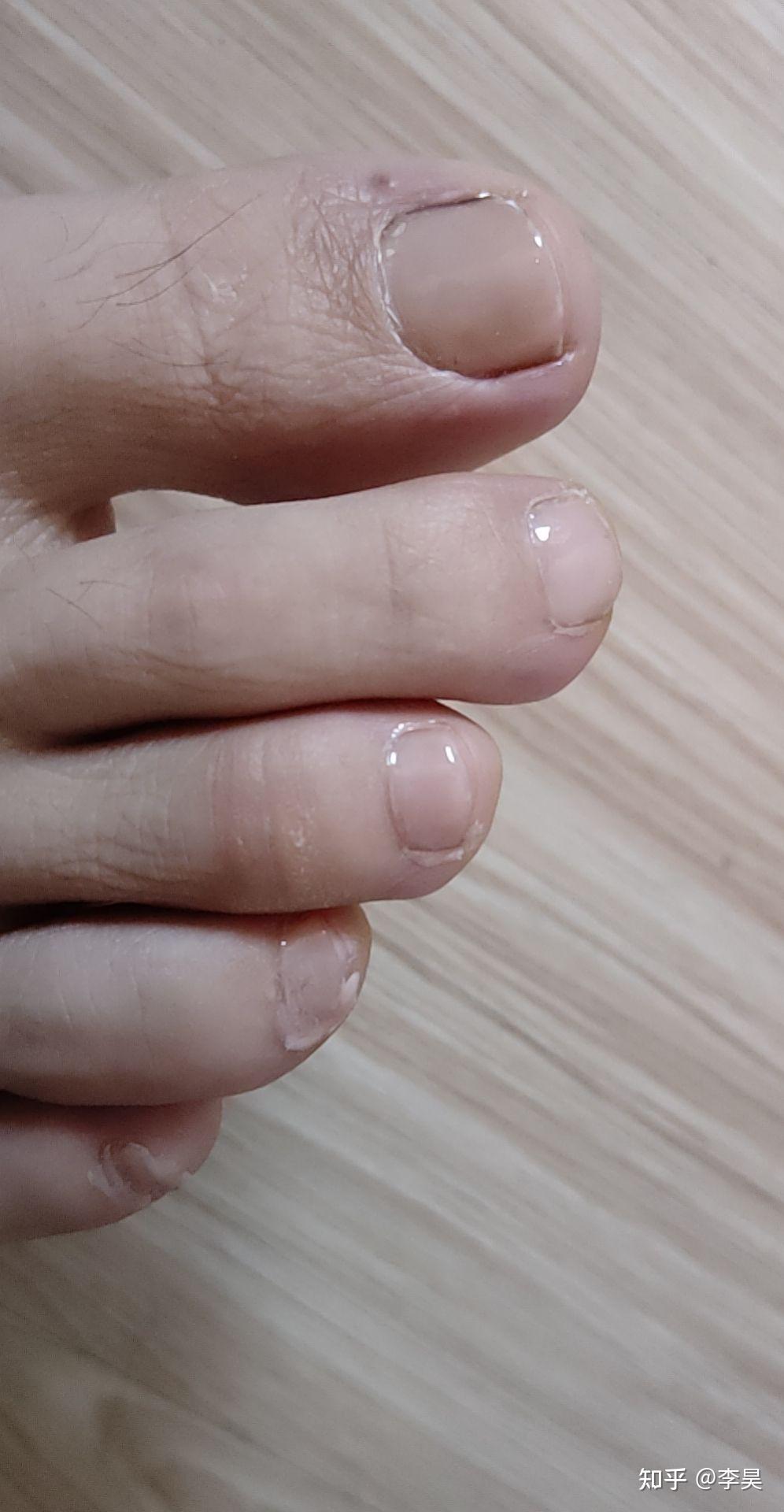 男生涂脚趾甲油是怎么想的?