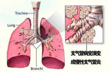 什么办法止咳嗽效果最快最好 v2-b6c48b5ff7de0fc2c3845ff05dc0598a_1440w.jpg?source=172ae18b