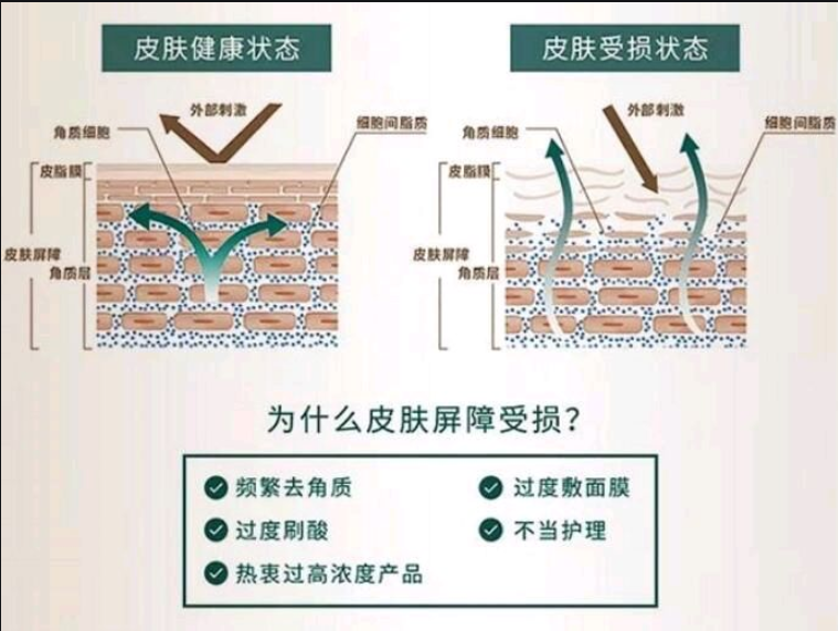 有哪些适合敏感肌的面霜推荐??