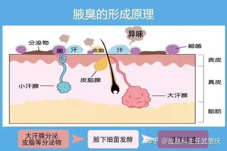 腋臭（狐臭）会传染吗？ - 知乎