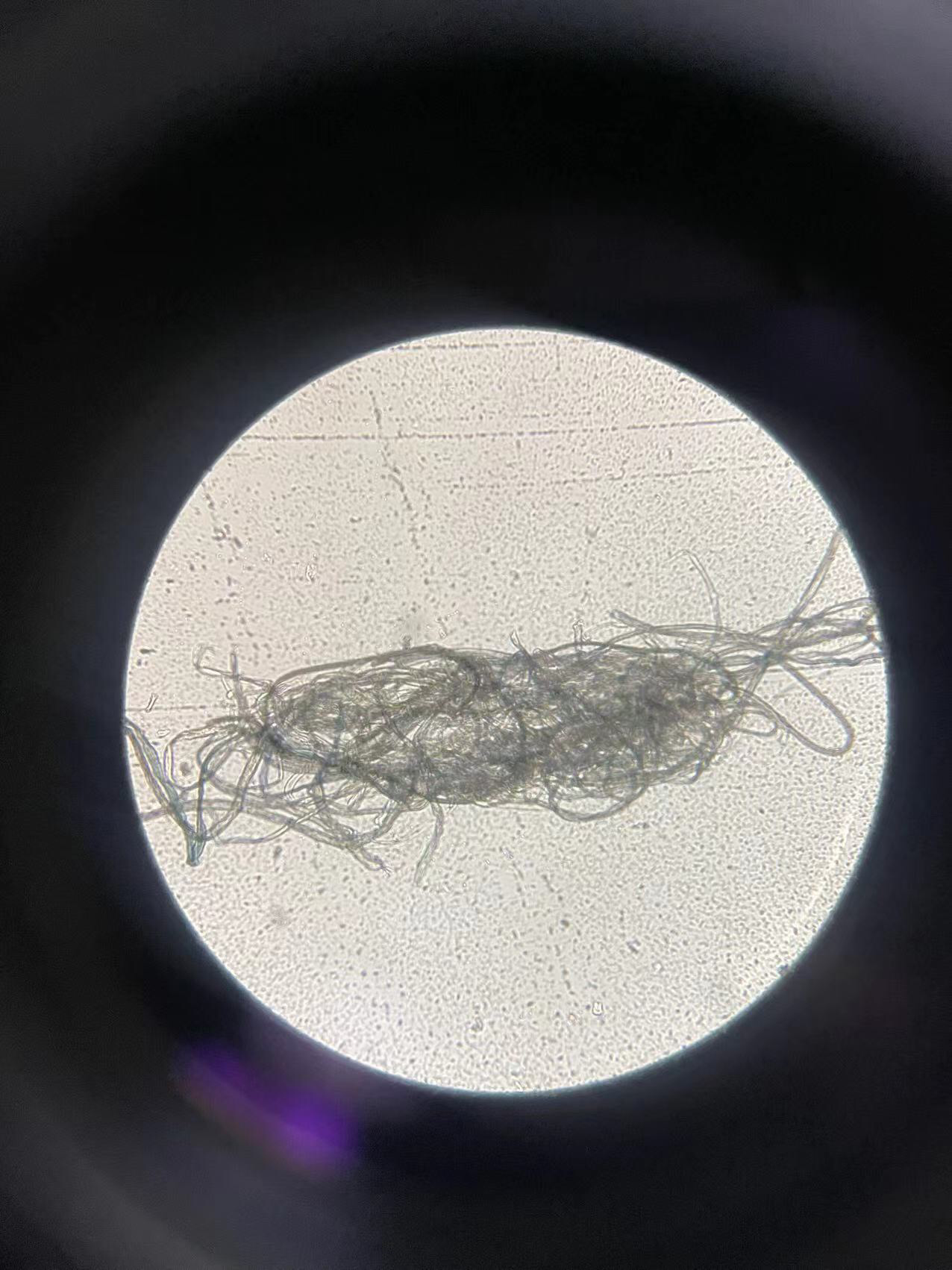 假定这是一种人体感染的肉眼可见的细菌,可能会是什么细菌?