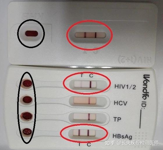 hiv检测试纸一条杠图片