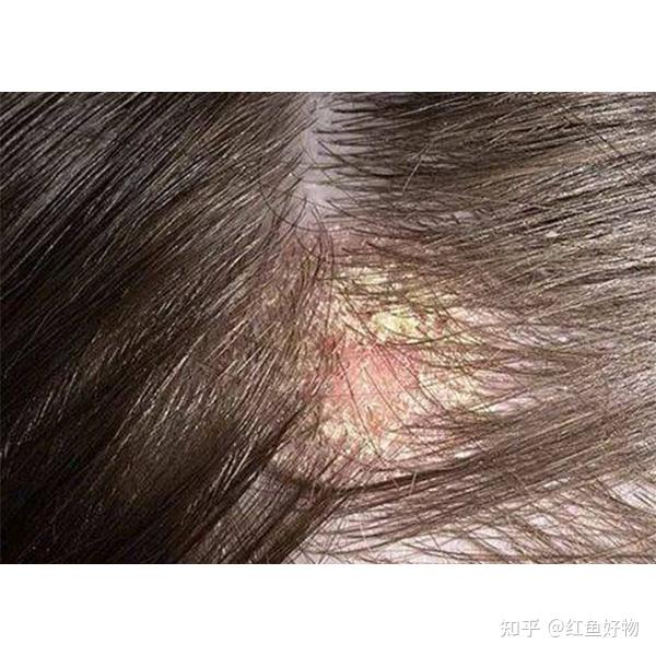 头屑头皮痒用什么洗发水好?去油止痒的洗发水排名 - 知乎