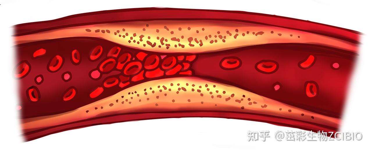 活化凝血因子 X(FXa):凝血瀑布中的关键枢纽|茁彩生物_化工仪器网