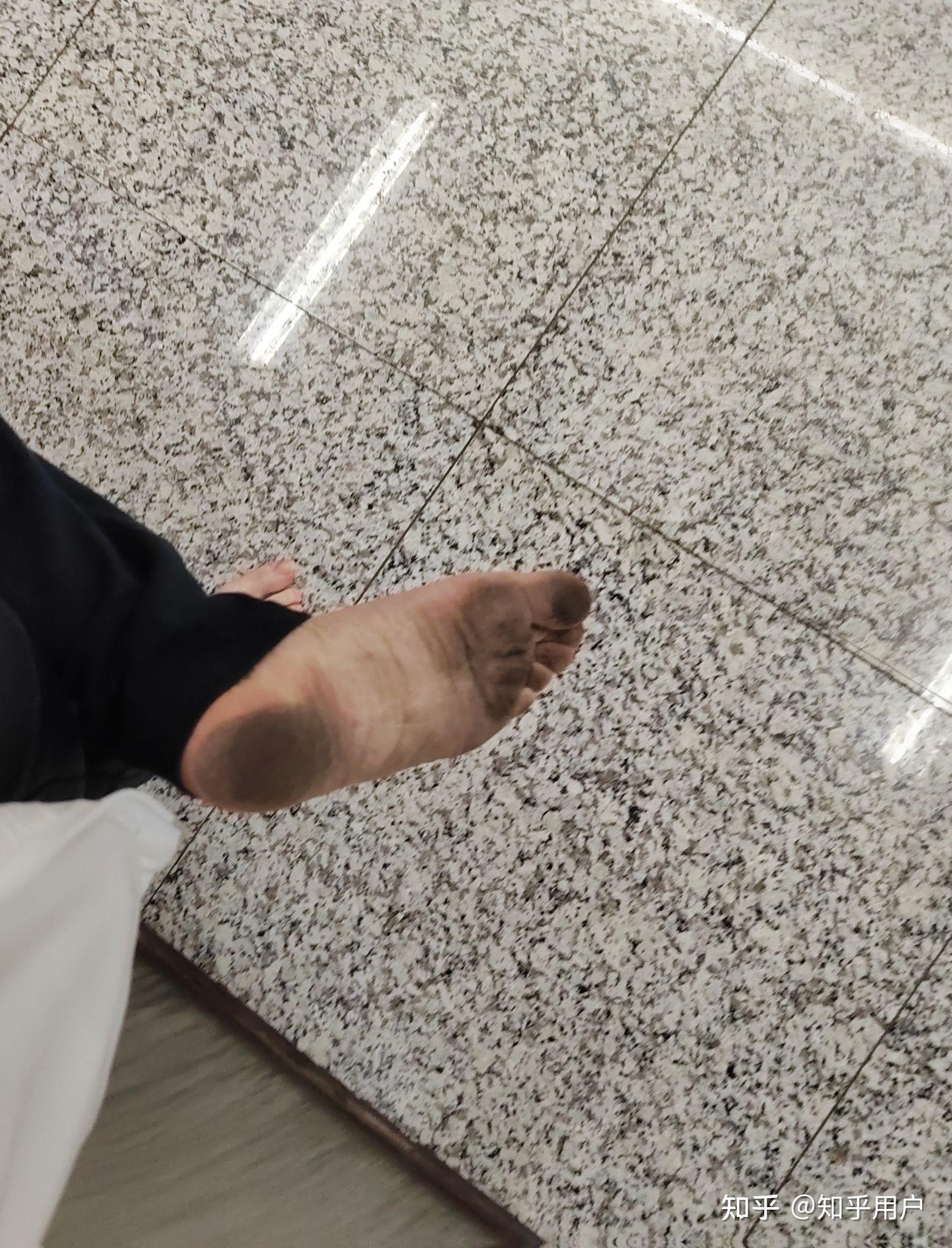 有没有赤脚外出的经历?