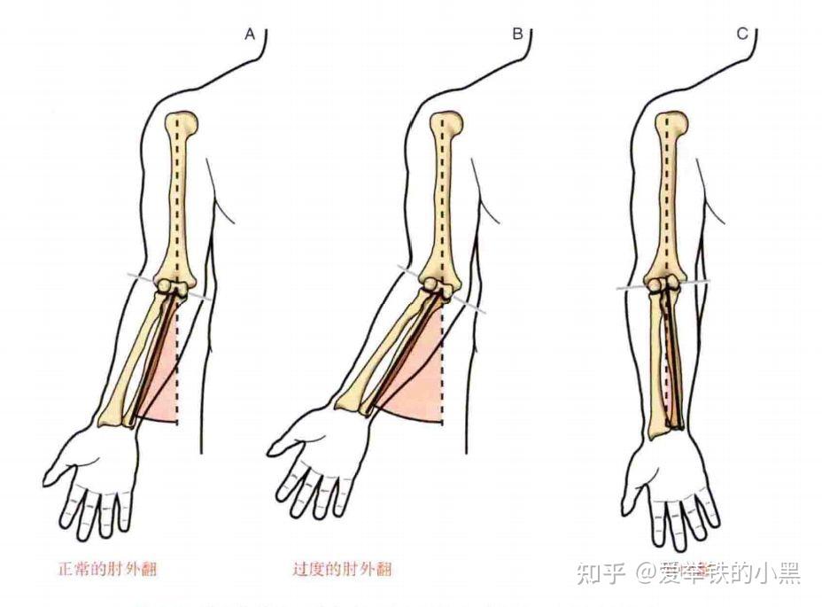 肘外翻有什么影响
