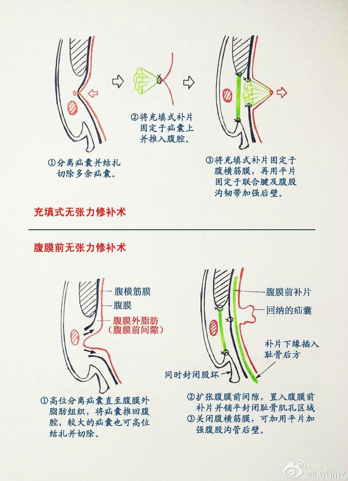 医生们怎么对待贫困人口