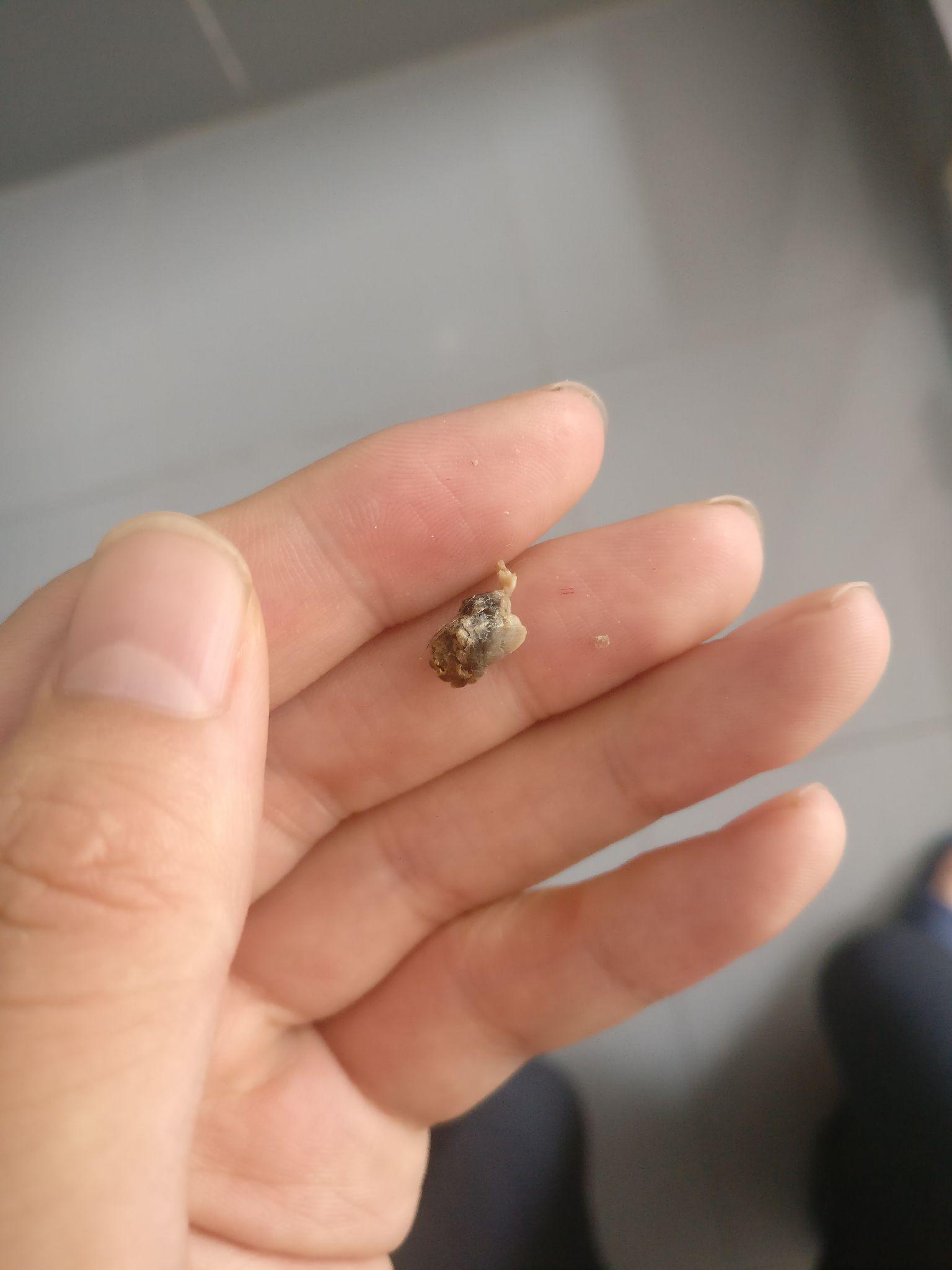 肚脐眼到底能不能抠脏了如何清洗