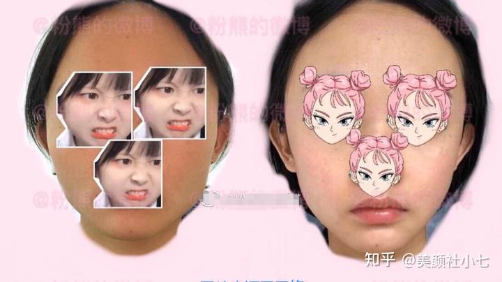 八大处面部轮廓整形功课-刘剑锋/靳小雷/尹琳 - 知乎