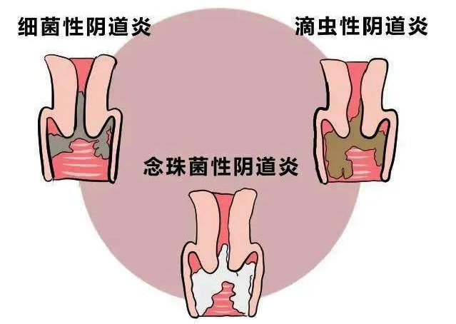 v2-b9fa1d43aa69a246785a35d369d5ade9_1440w.jpg?source=172ae18b
