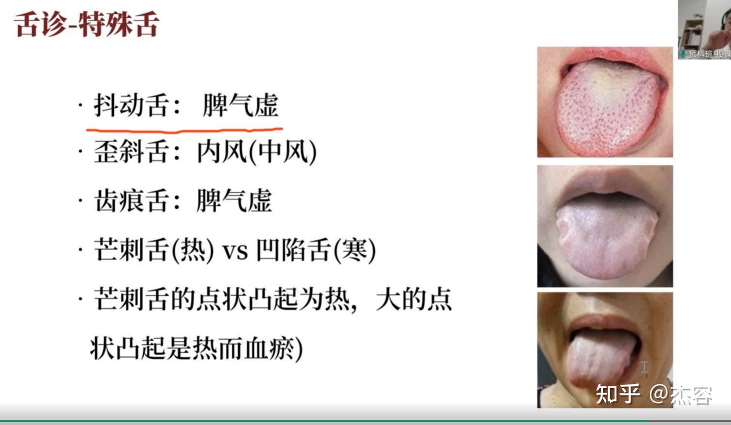 中医学习笔记5:舌诊 - 知乎