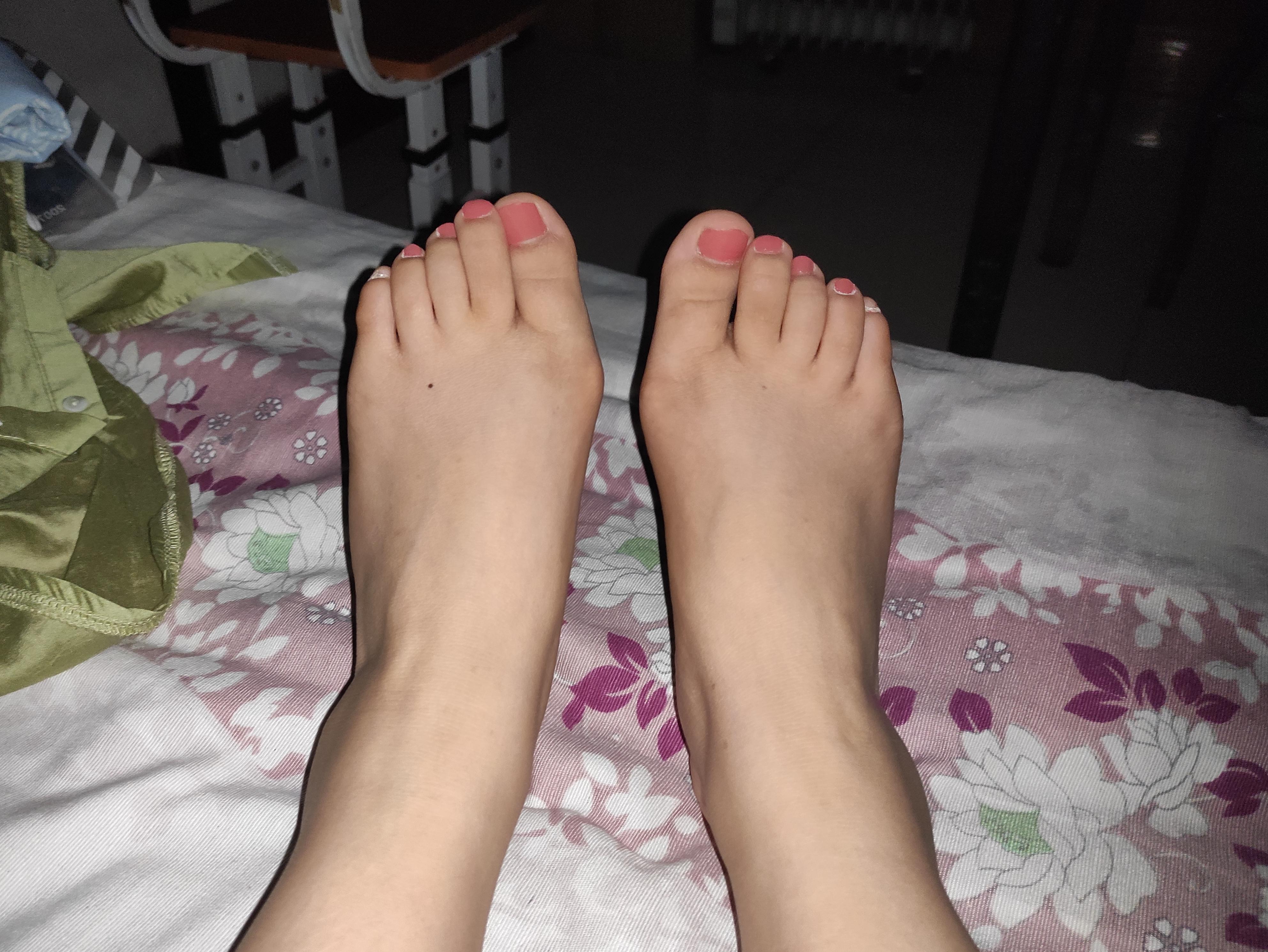 女生脚趾拇外翻是什么样体验