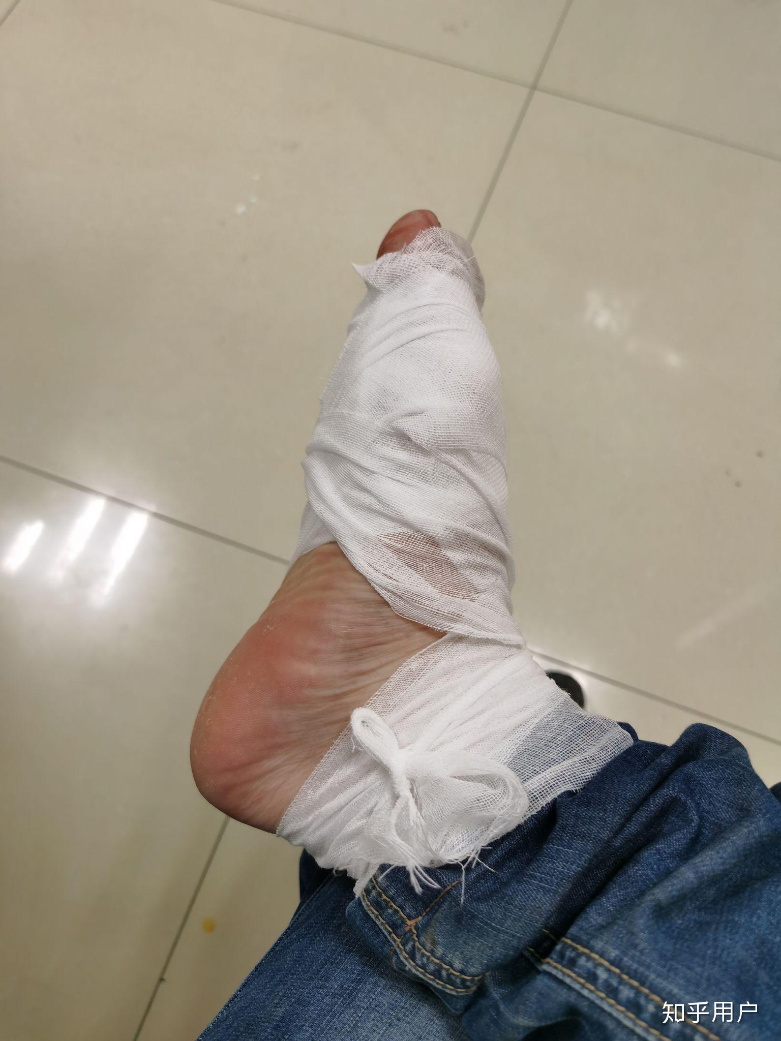 白血病治疗中的清创有多难受