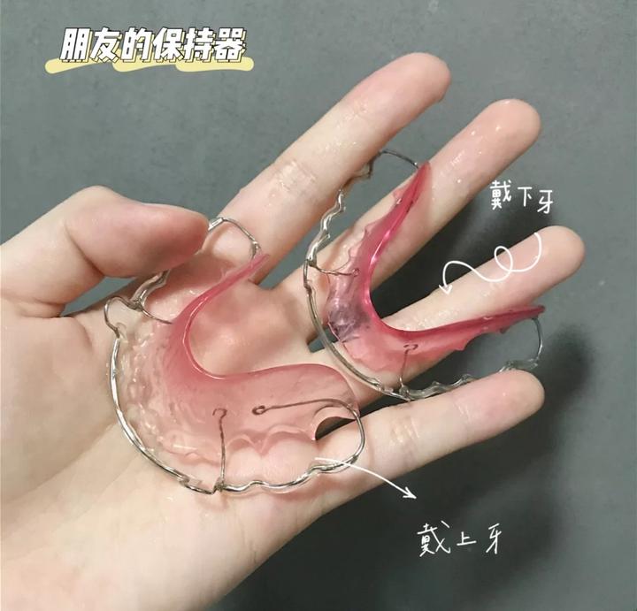 【西班的牙】|关于保持器类型科普 - 知乎