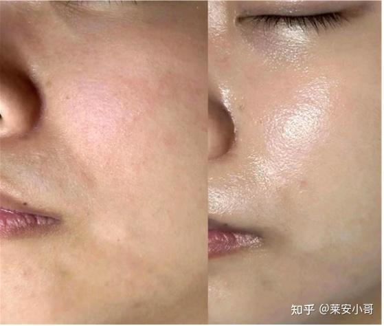 男士护肤品_男士水乳选择指南_油皮控油水乳推荐