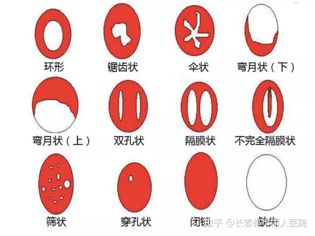 处女膜 关于处女膜，9成你不知道的问题- 知乎