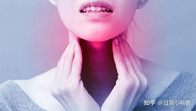 咽喉炎和咽喉癌分不清?预防咽喉癌,这五个预警要记住了! - 知乎