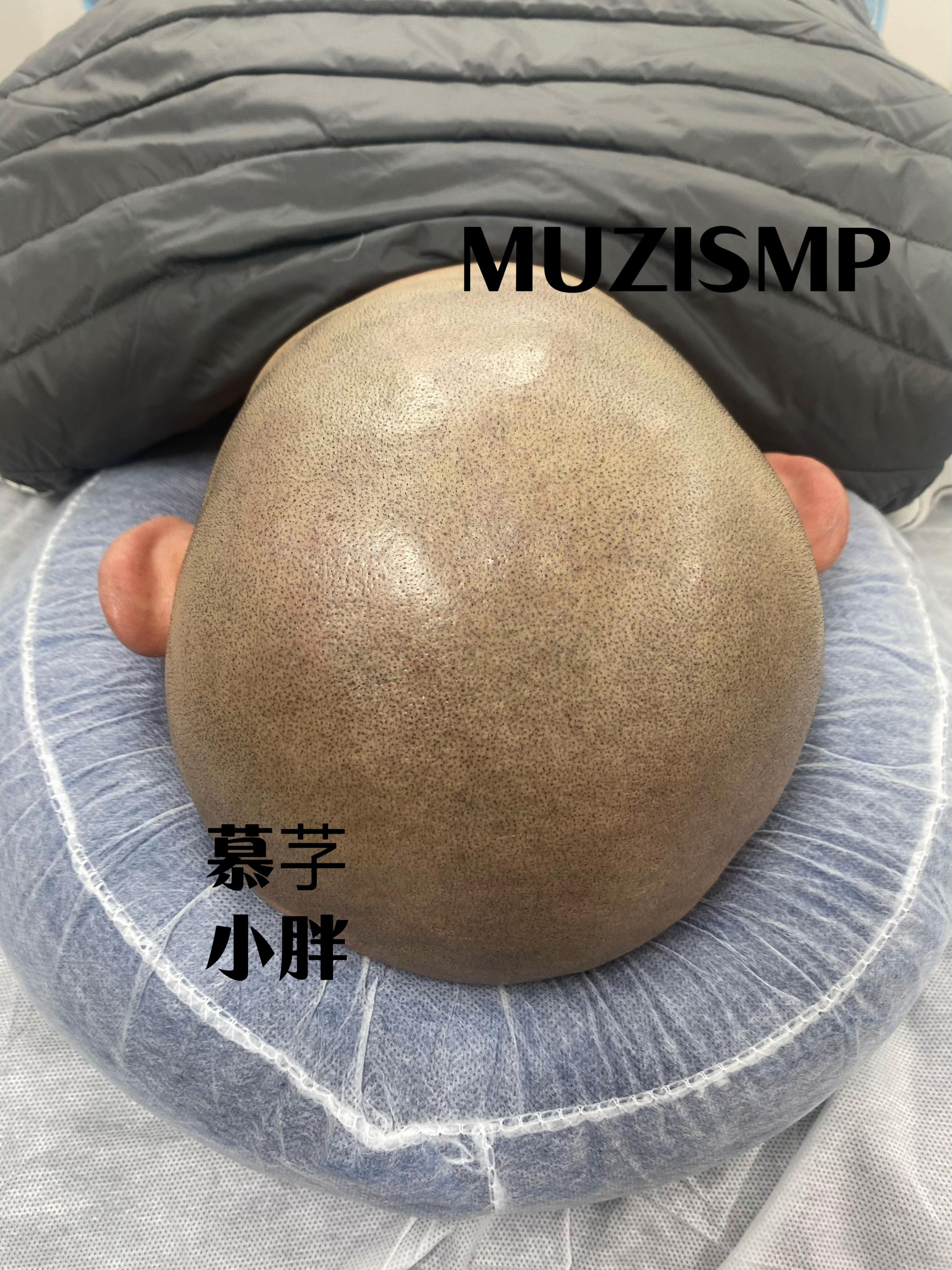 男生光头是种什么体验? - 知乎