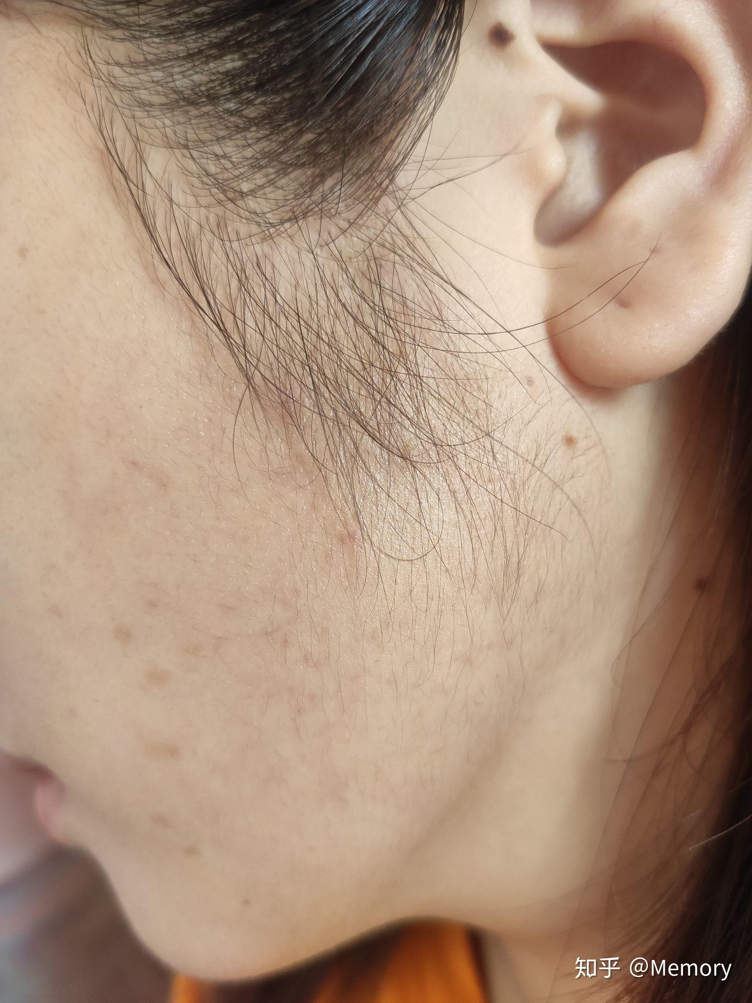 女生鬓角头发多且浓厚是一种怎么样的体验