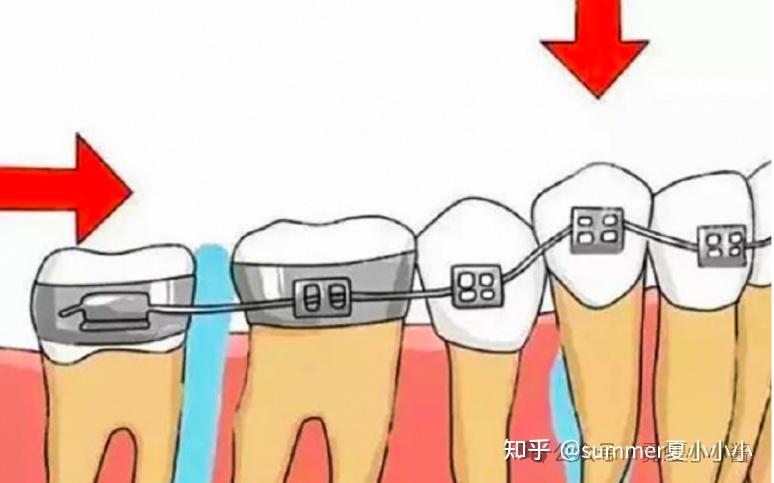 舌头贴上颚,能让鼻基底变高、脸变立体变好看? - 知乎