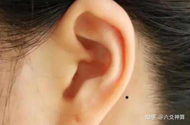 千万不能点掉的面相“暗财痣” - 知乎 千万不能点掉的面相“暗财痣” - 知乎