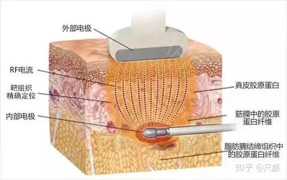 广昌：远程诊疗惠民生异地就医支出降1534%