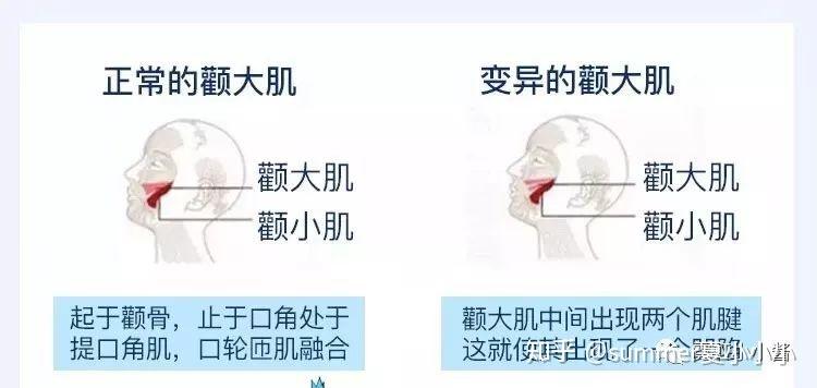 酒窝可以后天形成吗? - 知乎