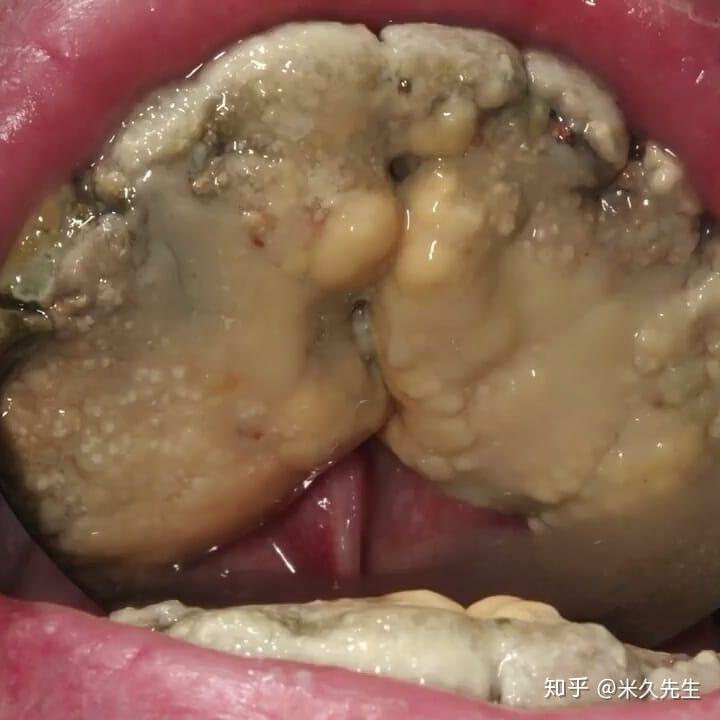 有多少人真的隔半年就去洗一次牙