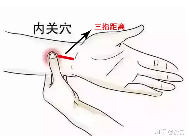 中医:内关透刺外关,可以阴阳并治,气血同调! - 知乎