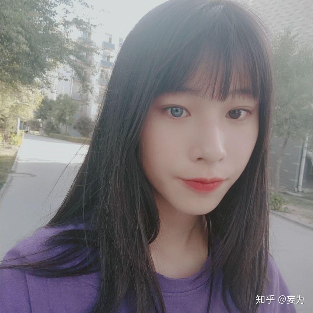 虹膜异色症是种怎样的体验