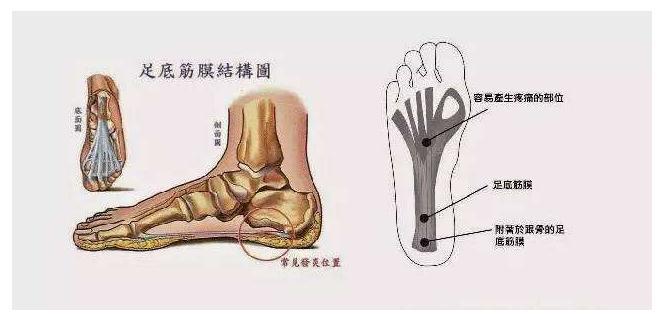 足筋膜炎最佳治疗方法 知乎