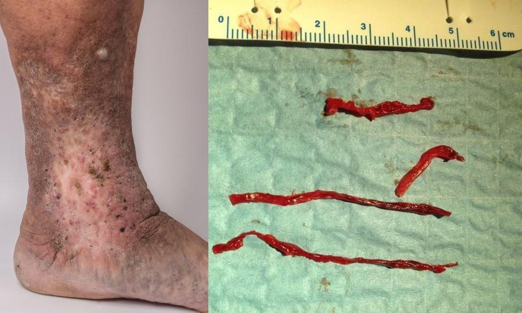 脚上有个化血栓开关打开它就可清血管防血栓