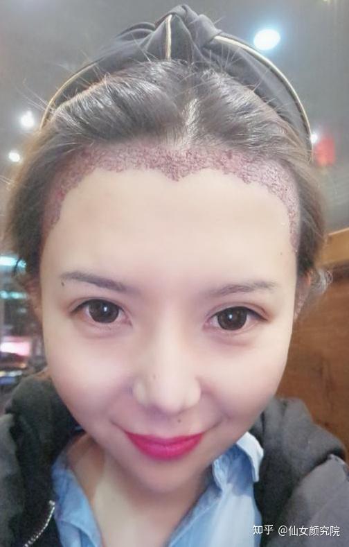 美人尖女生 知乎