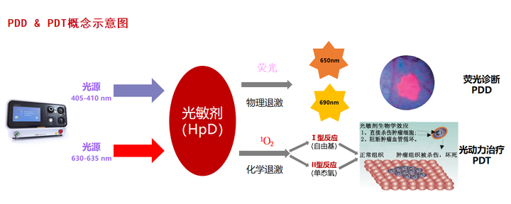 肿瘤光动力疗法（Photodynamic therapy，PDT） - 知乎