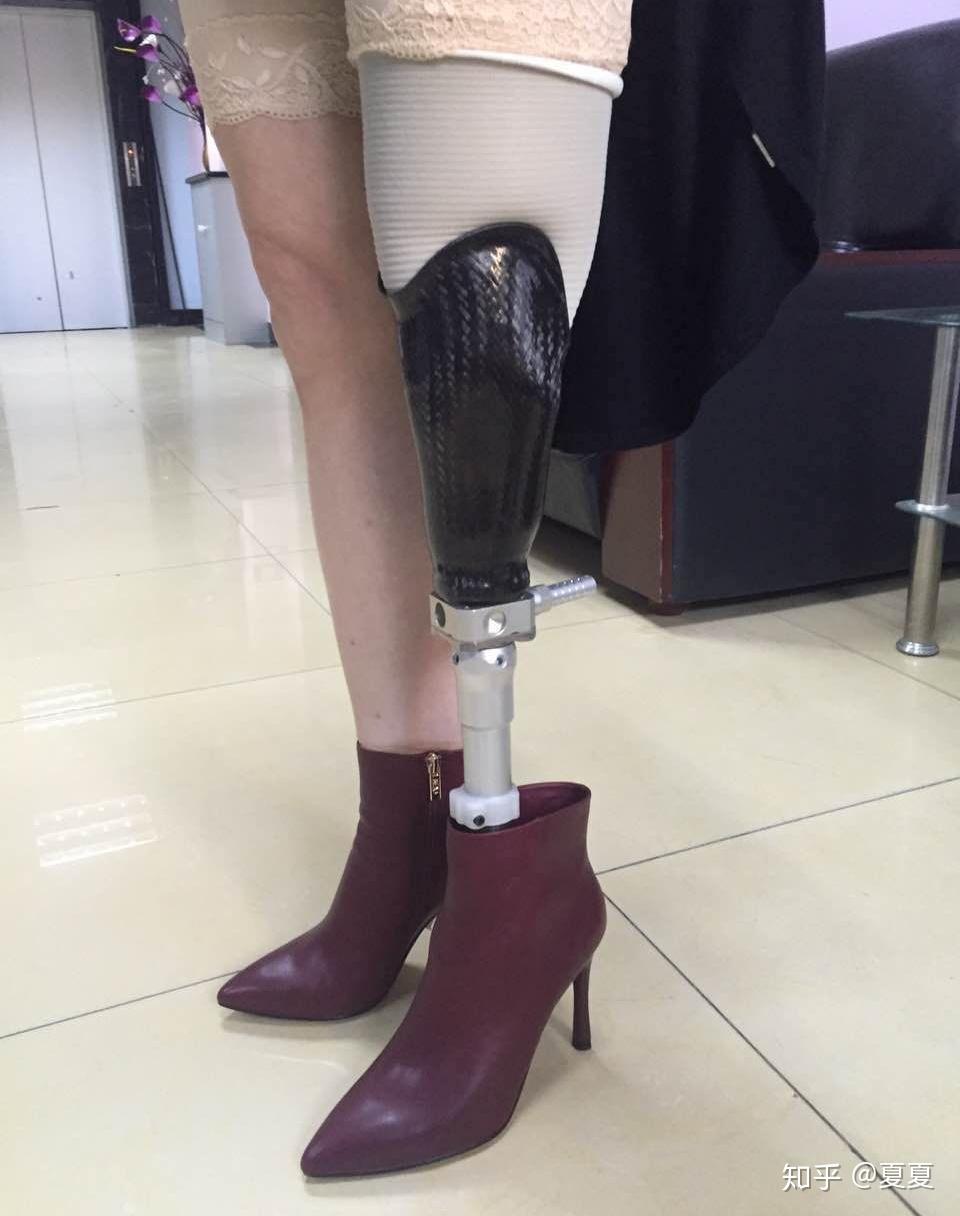 市场上可以跑步的小腿假肢有哪些品牌及型号均价多少